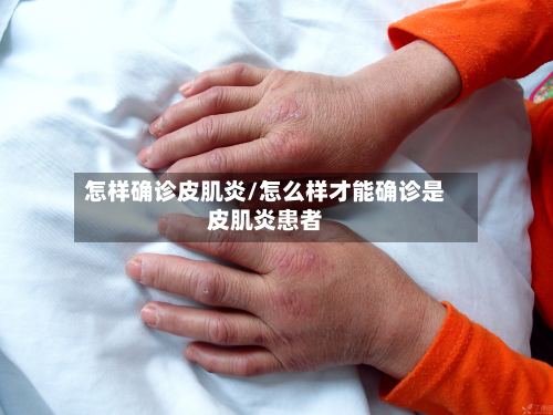 怎样确诊皮肌炎/怎么样才能确诊是皮肌炎患者-第3张图片