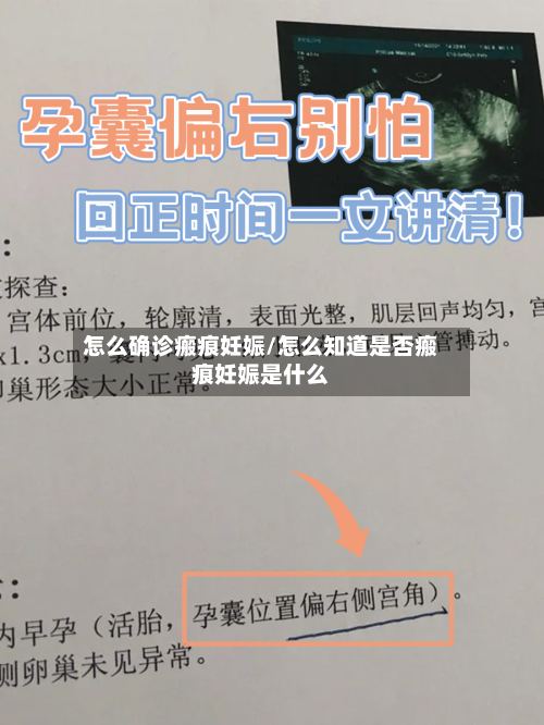 怎么确诊瘢痕妊娠/怎么知道是否瘢痕妊娠是什么