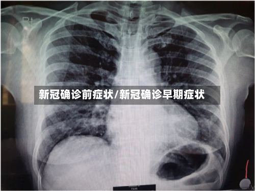 新冠确诊前症状/新冠确诊早期症状