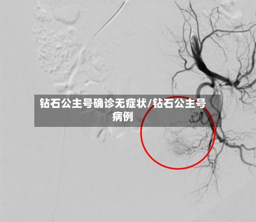 钻石公主号确诊无症状/钻石公主号病例-第2张图片