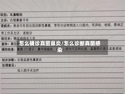 怎么确诊真菌鼻炎/怎么诊断真菌感染-第2张图片