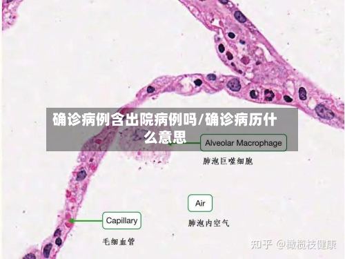 确诊病例含出院病例吗/确诊病历什么意思