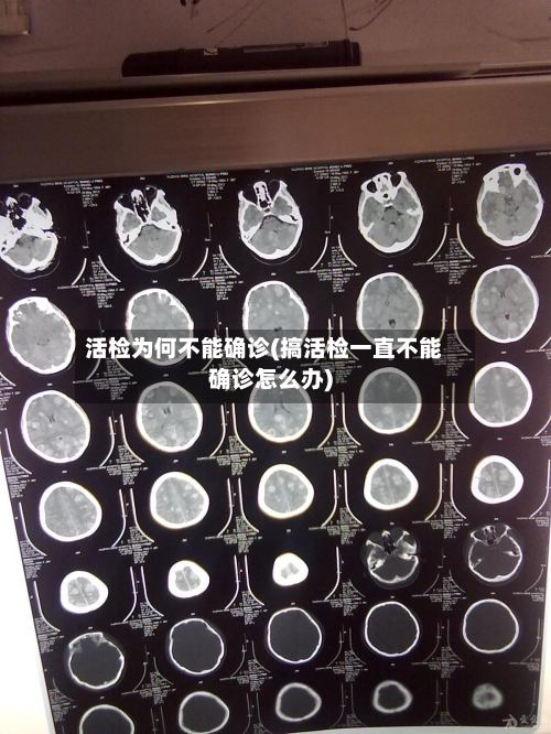活检为何不能确诊(搞活检一直不能确诊怎么办)-第3张图片