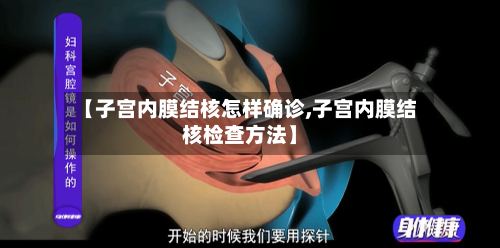 【子宫内膜结核怎样确诊,子宫内膜结核检查方法】-第2张图片