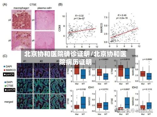北京协和医院确诊证明/北京协和医院病历证明