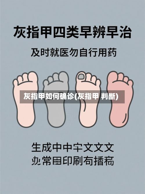 灰指甲如何确诊(灰指甲 判断)-第2张图片