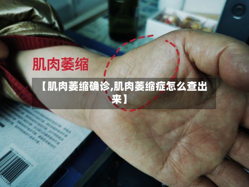 【肌肉萎缩确诊,肌肉萎缩症怎么查出来】
