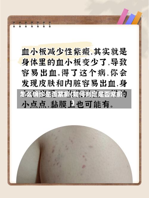 怎么确诊是否紫癜(如何判定是否紫癜)-第2张图片
