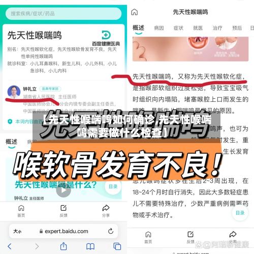 【先天性喉喘鸣如何确诊,先天性喉喘鸣需要做什么检查】