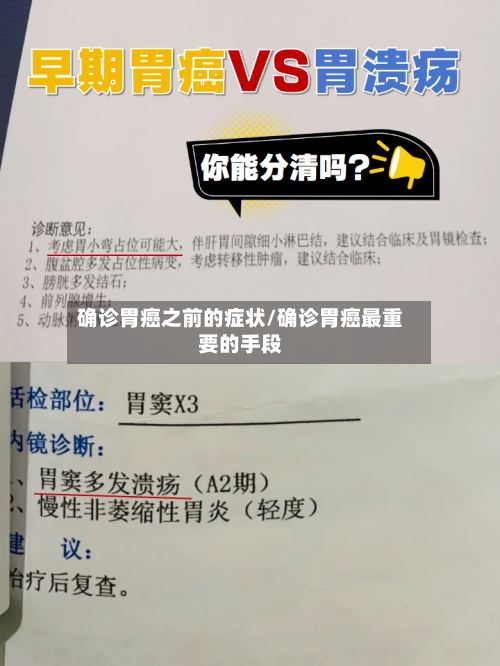 确诊胃癌之前的症状/确诊胃癌最重要的手段-第2张图片