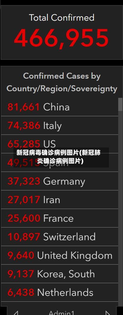 新冠病毒确诊病例图片(新冠肺炎确诊病例图片)