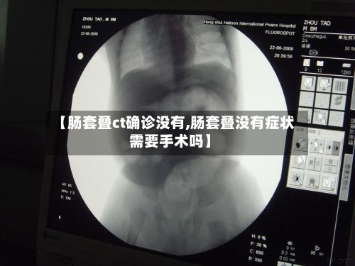 【肠套叠ct确诊没有,肠套叠没有症状需要手术吗】-第2张图片