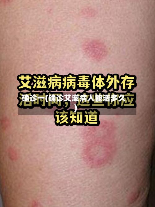 确诊一(确诊艾滋病人能活多久)