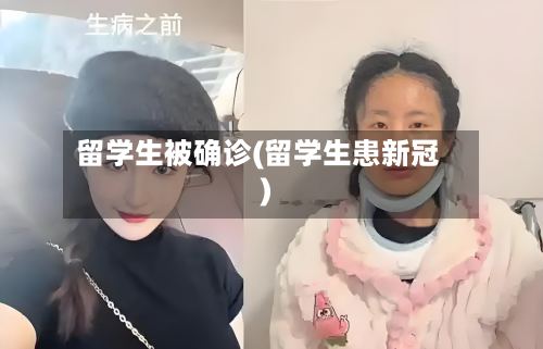 留学生被确诊(留学生患新冠)-第2张图片