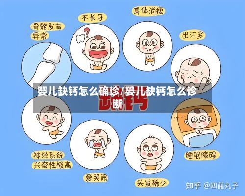 婴儿缺钙怎么确诊/婴儿缺钙怎么诊断