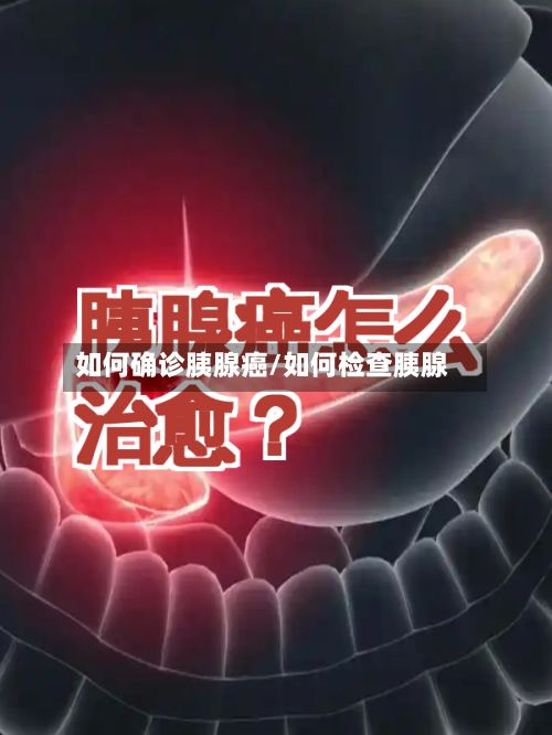 如何确诊胰腺癌/如何检查胰腺