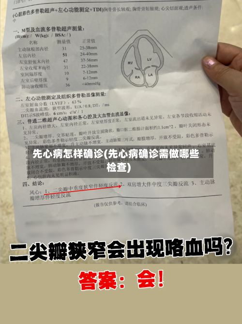 先心病怎样确诊(先心病确诊需做哪些检查)-第3张图片