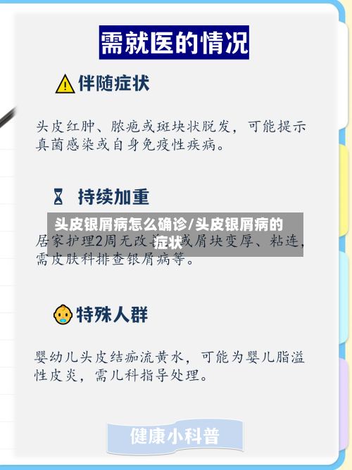 头皮银屑病怎么确诊/头皮银屑病的症状