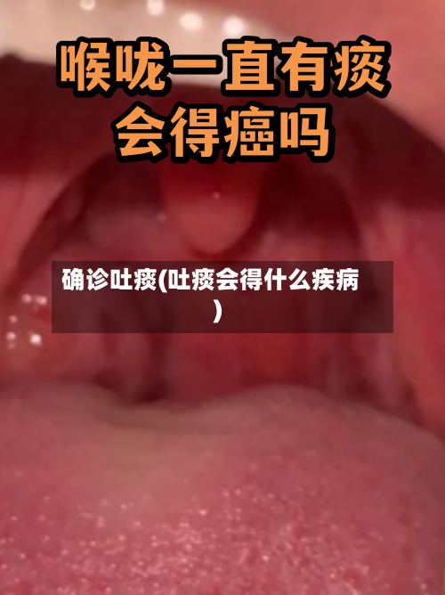 确诊吐痰(吐痰会得什么疾病)