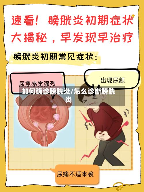 如何确诊膀胱炎/怎么诊断膀胱炎