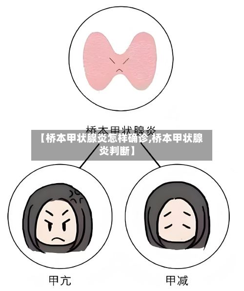 【桥本甲状腺炎怎样确诊,桥本甲状腺炎判断】