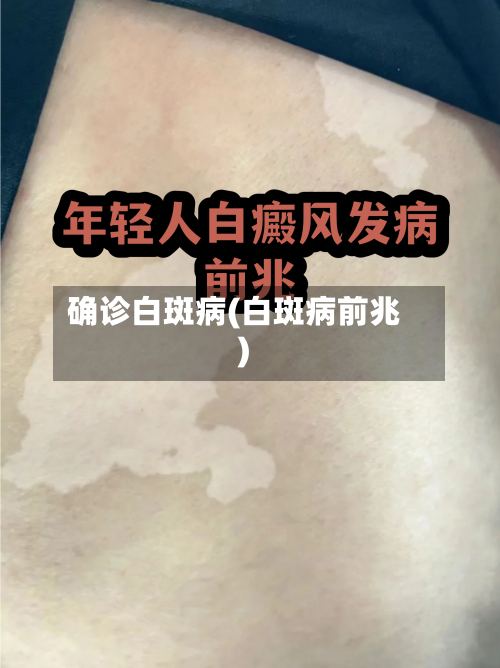 确诊白斑病(白斑病前兆)