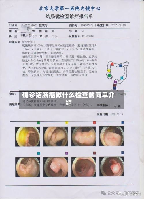 确诊结肠癌做什么检查的简单介绍-第2张图片